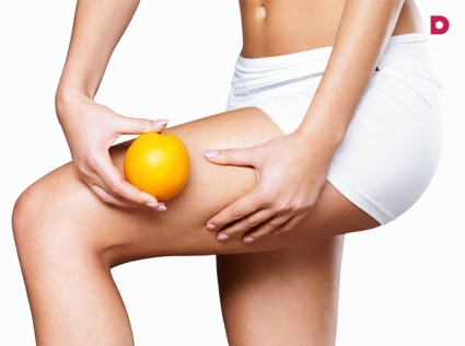 Долой апельсиновую корку! Избавляемся от целлюлита