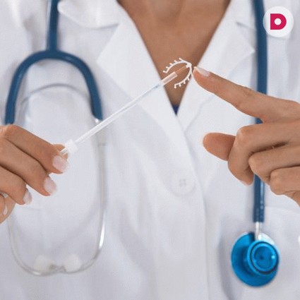 Внутриматочная спираль: положительные и отрицательные стороны контрацепции