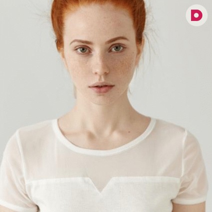 Как самостоятельно убрать веснушки на лице