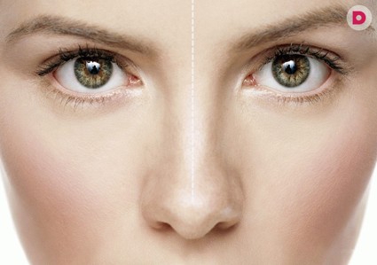 8 самых важных фактов о ринопластике