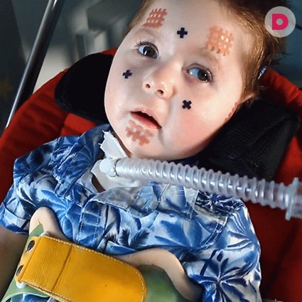 Мише Волченкову нужна ваша помощь!