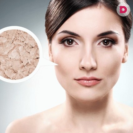 Как избавиться от шелушения кожи