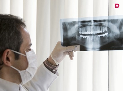 Имплантация зубов